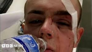 Bristol homophobic attack left victim in hospital