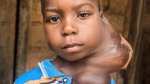 Daniels Tumor ist tödlich » Bitte hilf & spende