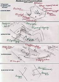 Abdominal Examination Wikipedia