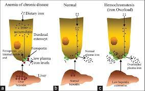 Hepcidin Mediated Regulation Of Iron Homeostasis A Increased Download Scientific Diagram