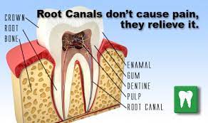When nerve damage occurs, the body tries to preserve the tooth by hardening the root and pulp. Pain After Root Canal Procedure Will The Pain Disappear