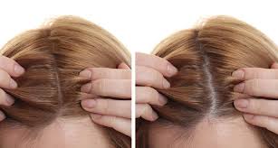 Yes, coffee drinkers are prone to hair loss. Coffee Does Magic In Your Hair Here S What Happens If You Stop Consuming Caffeine Lifestyle