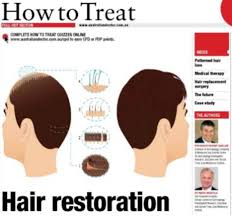 We are passionate hair experts treating men and women for ha. Hair Restoration Treatments For All Types Of Hair Loss Sinclair Dermatology