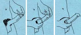 How Do I Know If A Man Is Wearing A Condom Correctly Center For Young Women S Health