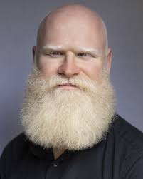 Talent agents for Chris Dent