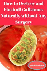 How To Destroy And Flush All Gallstones Naturally Without Any Surgery My Amazing Stuff Gallstones Gallbladder Surgery Galbladder Diet