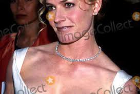 Just 30 Minutes Ago,Simone Biles Reveals She's Had 3 Plastic Surgeries,  Saying Fans 'Never' Would've Noticed Some of Them