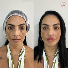 Eu vou te dar mais do que você me pediu. Seja paciente e confie em mim.”  Efésios 3:20