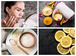 Proven kitchen remedies for dark spots