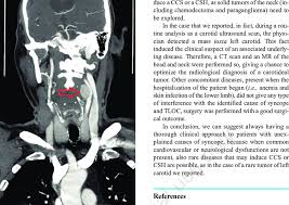 Image result for Chemodectoma