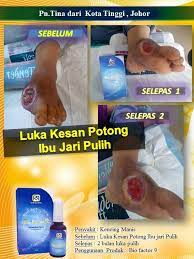 Dalam rawatan kencing manis, dikatakan ekstrak methanol daripada tumbuhan ini mampu meningkatkan perembesan insulin dan mengurangkan penyerapan gula ke dalam keberkesanan halba dalam mengawal penyakit kencing manis telah dikaji terhadap tikus makmal dan juga manusia. Bio Factor 9 Alternatif Diabetes å¸–å­ Facebook