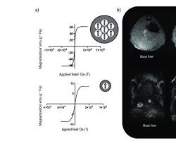 Hình ảnh về Fe3O4 nanoparticles used in MRI