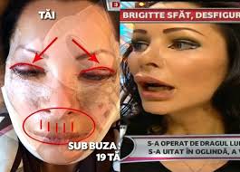 Citeste acum toate articole despre brigitte sfat pe digi24.ro. Ce Operatii Si A Facut Brigitte Sfat Aratam Ca Un Mutant Adpm