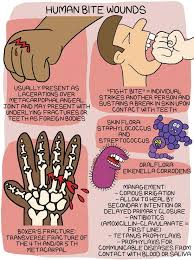 Image result for Human Bite