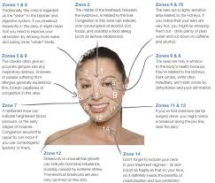 Face Mapping Can You Use It To Improve Your Skin S Health In 2020 Face Mapping Acne Face Acne Acne Mapping