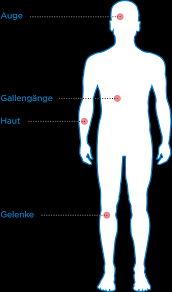Was Passiert Im Korper Bei Colitis Ulcerosa Ced Trotzdem Ich De