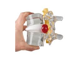 Image result for vyhřezlá ploténka