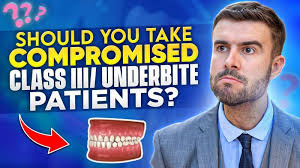 Taking Compromised Class III And Underbite Patients
