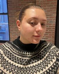 Dr. Dennis Gross LED Mask Review: Does it Work and Benefits 2024