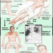 We did not find results for: Ù…Ø¹Ù†Ù‰ Ø¨Ø§Ù„Ø¹Ø±Ø¨ÙŠ Disorder