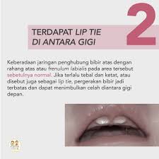 Dari dua poin di atas sebenarnya untuk membedakan antara di disambung dan dipisah sudah dapat dipahami jelas bukan? Goodsaregood Facebook