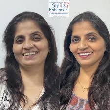 Dr.Kenal shah Dr.Alka Thakkar shah (@smileenhancerdental) · Thane