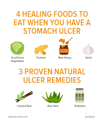 11 Signs You Have A Stomach Ulcer Natural Remedies Stomach Ulcers Stomach Remedies Ulcers