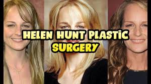 Radar online showed its readers the new appearance of helen hunt that . Helen Hunt Plastic Surgery Youtube
