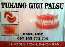 Gigi tiruan ini dibuat sangat mirip dengan gigi asli. Pasang Gigi Palsu Photos Facebook