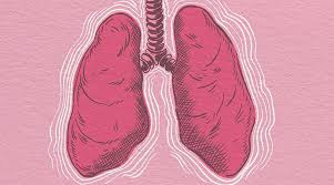 Image result for Pneumonia