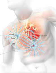 The axon taser® is the best shooting stun gun on the market. How A Taser Works Ieee Spectrum