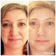 I'm 38 weeks and omgg I'm so insecure with my body/skin cause I got some  Dark spots 🥺, it's something that I can use? (Safe)