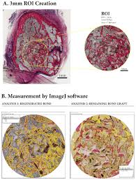 To learn the structures found in compact bone. Materials Free Full Text Histological And Histomorphometric Analyses Of Bone Regeneration In Osteoporotic Rats Using A Xenograft Material Html