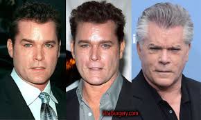 Ray liotta plastic surgery before and after american actor, film producer explained here at this page ray liotta before plastic surgery and after ray . Ray Liotta Plastic Surgery Before And After Facelift Pictures