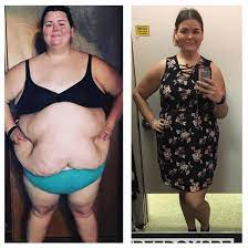 „meine fettsucht hätte mich fast umgebracht abnehmen tipps 2014: Mutiges Vorher Nachher Foto 24 Jahrige Nimmt 83 Kilo Ab