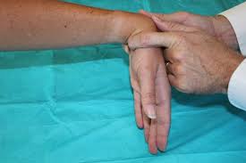 Image result for Carpal Compression Test