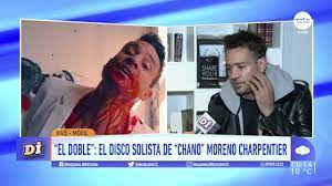 Santiago chano moreno carpentier fue operado de urgencia este lunes tras recibir un disparo en el abdomen al forcejear con un efectivo de la policía bonaerense.durante la intervención, le extirparon parte del páncreas, el bazo y el riñón izquierdo, y le saturaron una perforación del colon, según informaron. Chano Moreno Charpentier Me Gustaria Vivir En Uruguay Youtube