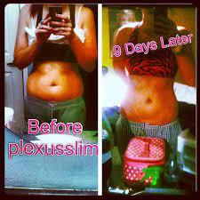 Pin On Health