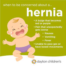 Image result for Inguinal hernia child