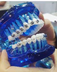 Teeth Tooth Toothless Extraction Cirugiabucal Oralsurgery Dental Dentist Dentistry Matteonegri Dentalhygiene Dentalassistant Ortodontia Dentistas Odontologia