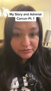 My Story with Adrenal Cancer. PT. 1 #adrenocorticalcarcinoma #adrenal...