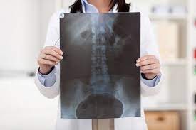 Penyebab utama dari sakit pinggang adalah karena otot atau ligament terkilir sehingga meregang secara berlebihan. Sakit Pinggang Penyebab Dan Mengobati Alodokter