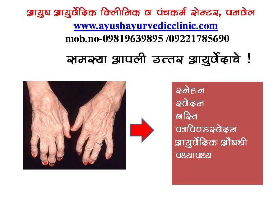 rheumatoid arthritis treatment 20 % off product image