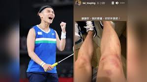 Jun 02, 2021 · 2016 里約奧運羽球女單金牌得主、西班牙名將瑪琳，日前訓練時左膝前十字韌帶與半月板撕裂，本週將接受手術治療，並提前宣布退出東京奧運，這也意味著戴資穎少了一大勁敵。目前世界排名第4的瑪琳（ carolina marin ），今年6月 15 日才滿 28 歲，是今年東京奧運的金牌候選人之一，她不但是上屆里. Rtilpzbakobopm