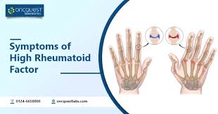 Image result for Rheumatoid Factor