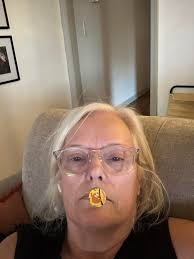 What causes premature white hair?