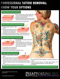 Tattooremovalnatural Laser Tattoo Removal Tattoo Removal Tattoo Removal Cost