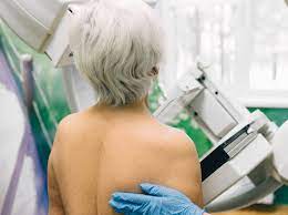 Wann sollten sie zur mammographie? Mammographie Ab Wann Frauen Zum Screening Sollten Liebenswert Magazin