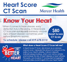 Image result for HEART Score