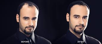 Truly a full head of hair in 30 seconds? of all the hair loss concealers available, like topical powder although toppik is popular and well known within the hair restoration community, hair loss sufferers should still ask one crucial question: Men S Hair Loss What You Need To Know